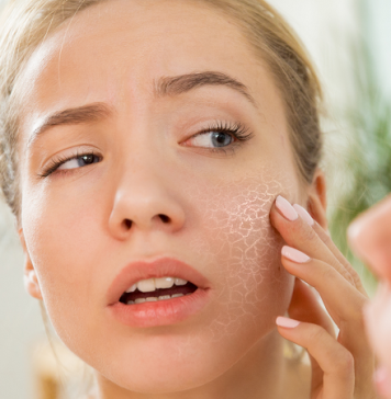 Dry Skin Care Tips to Help You Achieve Healthy, Glowing Skin