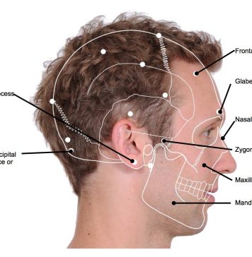 Anatomy of the Mastoid Foramen