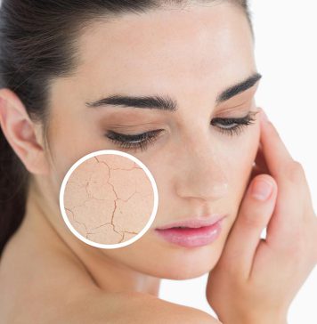 How to Fix Dry Face For Good